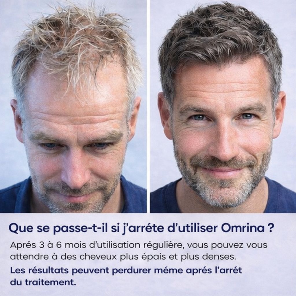 OmrinaGrow™ – Système de Repousse Capillaire Haute Performance