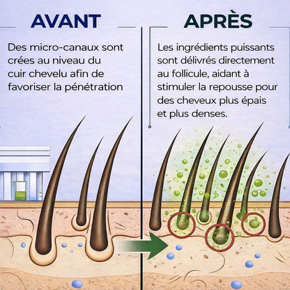 OmrinaGrow™ – Système de Repousse Capillaire Haute Performance