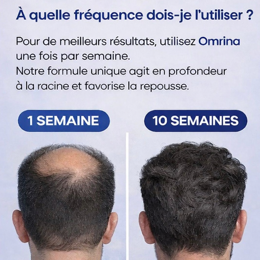OmrinaGrow™ – Système de Repousse Capillaire Haute Performance