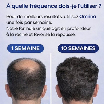 OmrinaGrow™ – Système de Repousse Capillaire Haute Performance